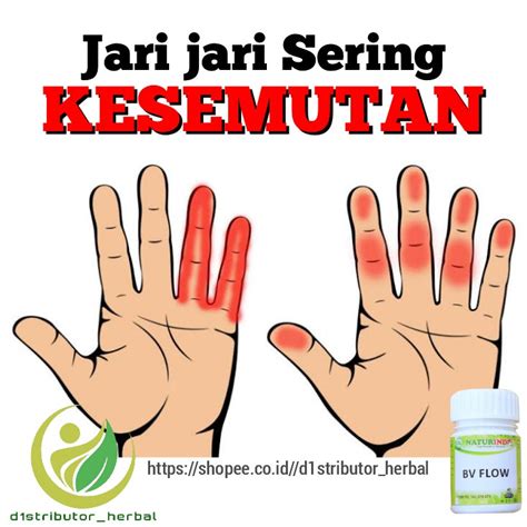 Cara Mengobati Sering Kesemutan