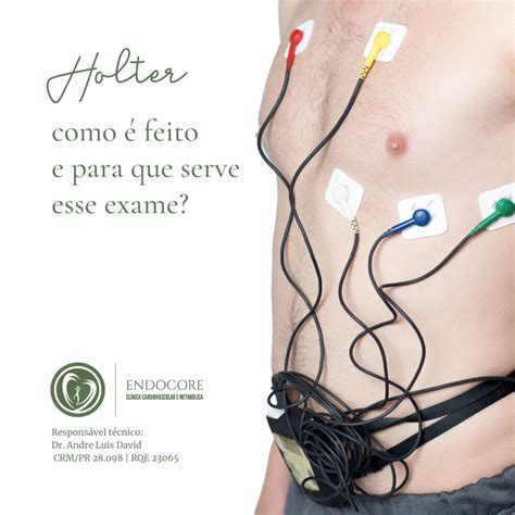 Holter como é feito e para que serve esse exame Endocore