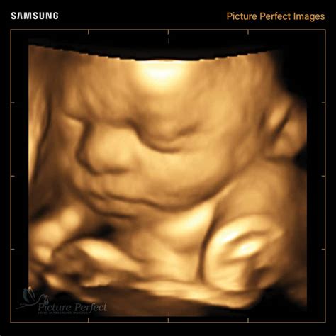 Home Picture Perfect D D Ultrasound