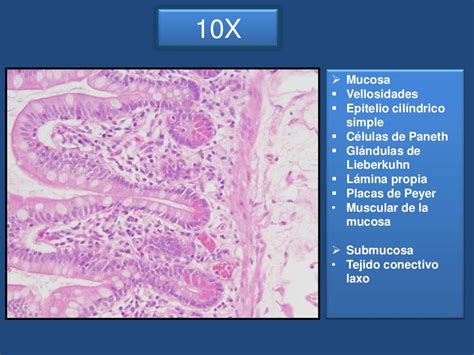 Intestino Delgado