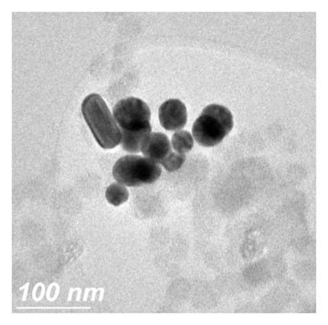 Transmission electron micrographs of P103 polymer like micelles loaded ...