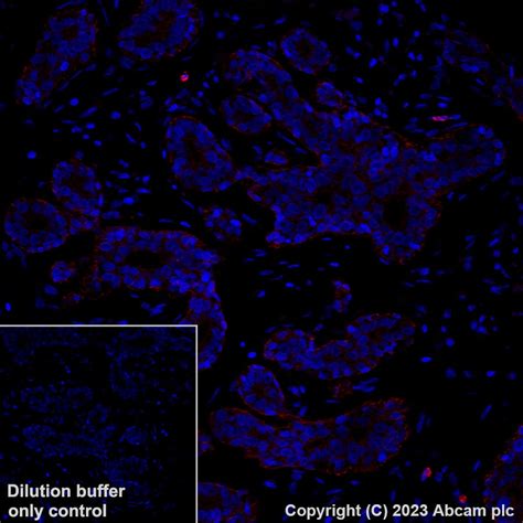 Recombinant Alexa Fluor 647 Anti P Cadherin Antibody EPR22426 Ab314928