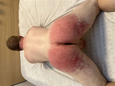 My Ass Being Whipped By My Master Pics Xhamster