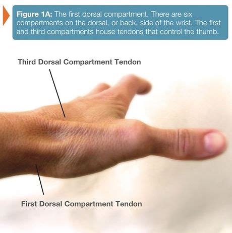 Thumb Tendonitis | Jonathan Twu MD