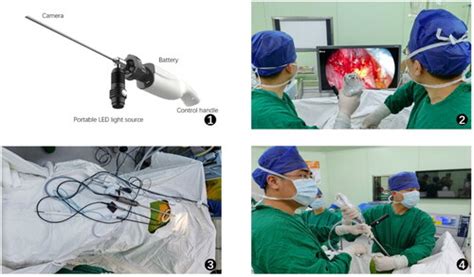 full article application  wireless thoracoscopy  thoracic surgery