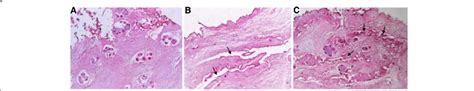 Hematoxylin And Eosin Stained Sections Original Magnification × 200