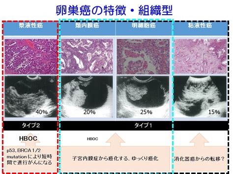 7 遺伝性乳癌卵巣癌症候群（hboc）の特徴 日本産婦人科医会