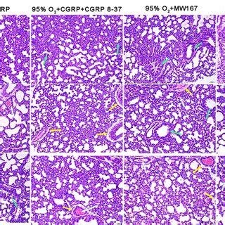 Histopathological Analysis Of Lung Tissues From Hyperoxia Induced Lung