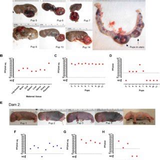A comparison of the typical ploidy and p57 status in molar pregnancies
