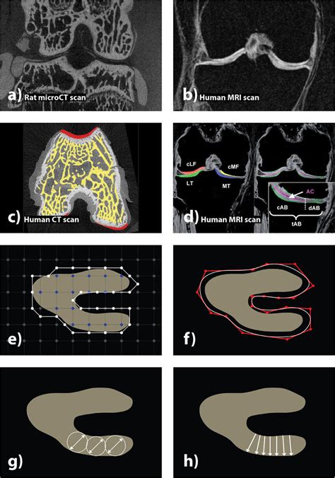 A Coronal View Of A Contrast Enhanced MicroCT Scan Of The Rat TFJ