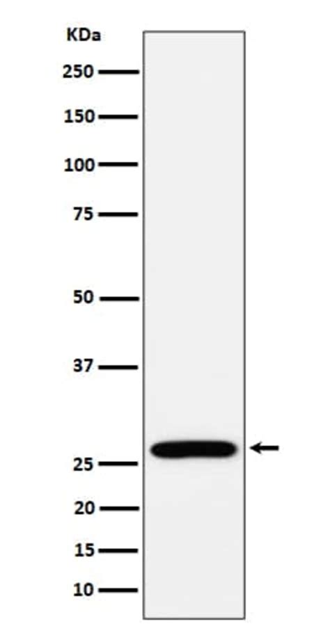 RPL13 Antibody (SR1422), Novus Biologicals 100 μg; Unconjugated ...