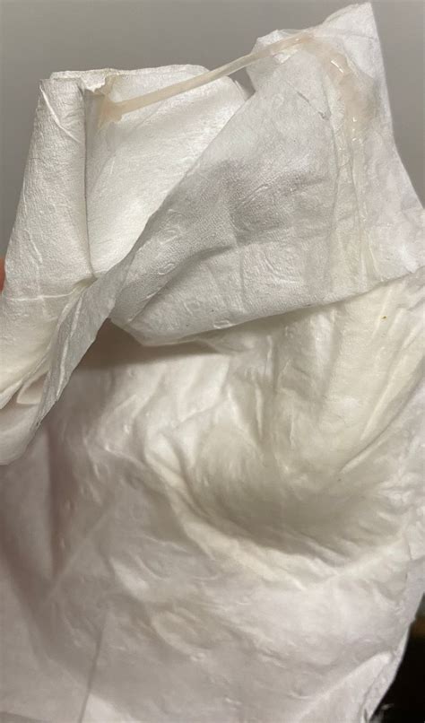 Whats This Vagina Addition Obvious TMI BabyCenter