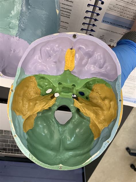 Skull Superior View W Calvaria Removed Diagram Quizlet