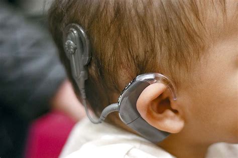 What Cochlear Implants Did For My Son Wsj