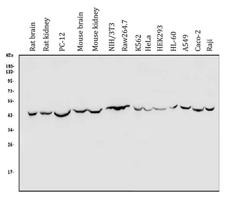 Anti Txnip Antibody Arg Arigo Biolaboratories