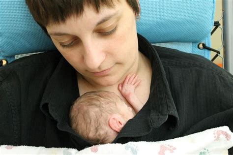 Digeorge Syndrome What Is It Symptoms Diagnosis Treatment And