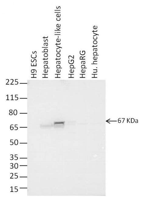 AFP Monoclonal Antibody P5B8 Invitrogen 100 μg Unconjugated Ver