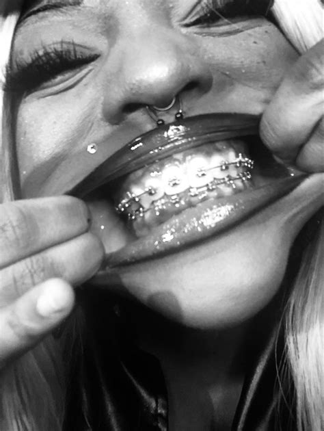pin  donna jean   vision board teeth aesthetic silver braces