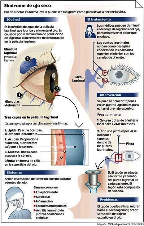 Ojo AlÉrgico Seco Grave Y SjÖgren Recomendaciones Y Tratamiento Del