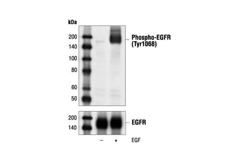 Epidermal Growth Factor Human Egf Cell Signaling Technology