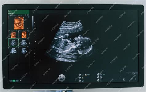 Premium Photo | Pregnant baby infant ultrasound display Conception of ...