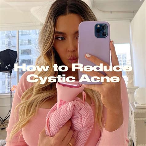 How To Reduce Cystic Acne | The Skinny Confidential