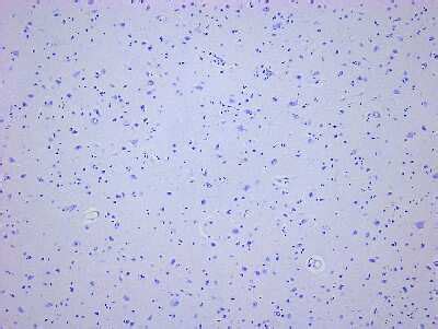 Brain Parietal Lobe Tissue Slides Dementia Paraffin NBP2 77839