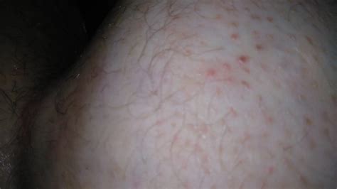 Bbc Fucks My Huge Chub Ass Gay Porn Xhamster