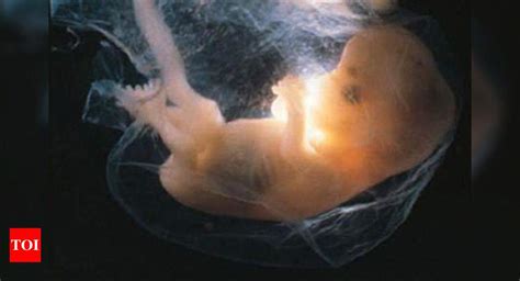 Boy Or Girl Mother S Bp May Predict Sex Of Baby Times Of India