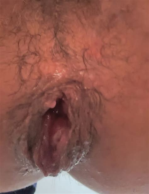 Fiti Culo Roto Nude Pics Xhamster