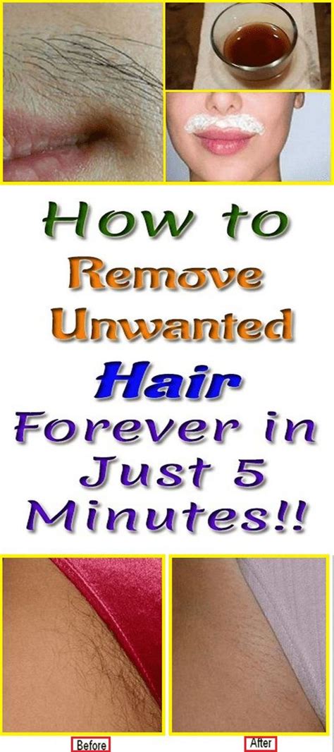 Remove The Mustache And Other Unwanted Hair From The Body Forever