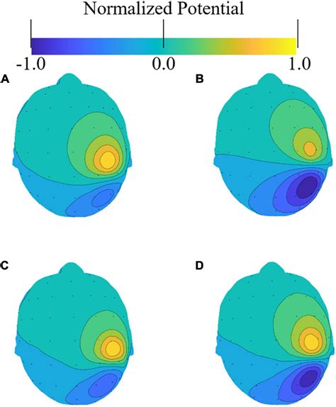 Frontiers High Resolution Eeg Source Localization In Segmentation