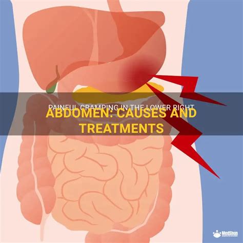 Painful Cramping In The Lower Right Abdomen: Causes And Treatments ...