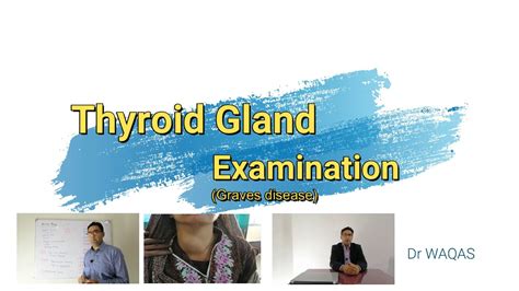 Thyroid Examination Youtube