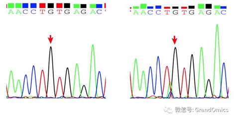 重大成果 Nanopore测序精准鉴定基因组结构变异，让全外显子组检测阴性案例得到确诊，为pgd提供重要参考外显子基因组测序新浪新闻