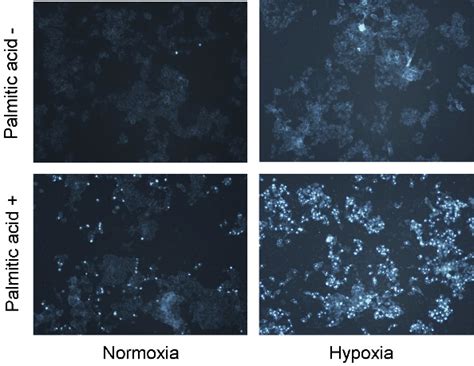 HepG2 cells were cultured with PA (1 mM) under either standard or ...