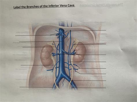 The Branches Of The Inferior Vena Cava Diagram Quizlet