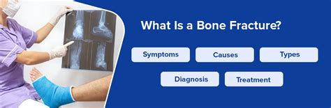 What Is Bone Fracture Its Symptoms Causes Types Diagnosis And