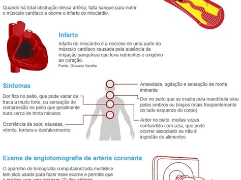 G1 Campanha Orienta Sobre Prevenção A Doenças Cardiovasculares Em Mg