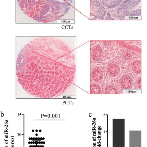 Mir 26a Is Upregulated In Crc Tissues A A Representative Full Image