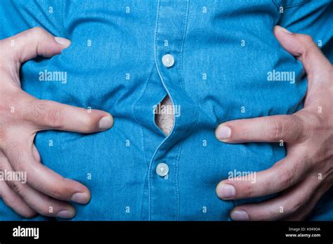Swollen Abdomen Hi Res Stock Photography And Images Alamy