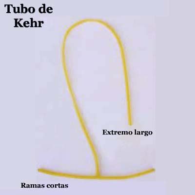 El tubo de Kehr – Todo lo que un cirujano debe saber