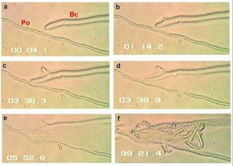 Pythium Oligandrum Alchetron The Free Social Encyclopedia