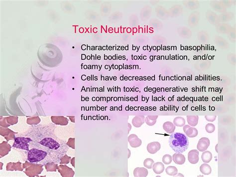 Toxic Neutrophils