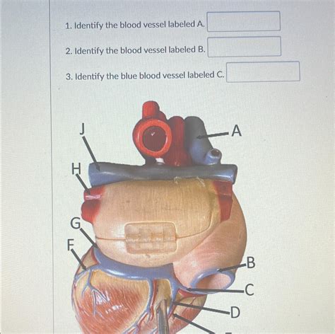 Solved Identify The Blood Vessel Labeled A Identify The Chegg