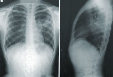 HSE: Protect Workers from Fatal Lung Disease - Red On line (COM)