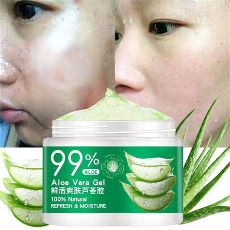 Buy Anti Acne Natural Aloe Vera Gel Natural Face Creams Moisturizer