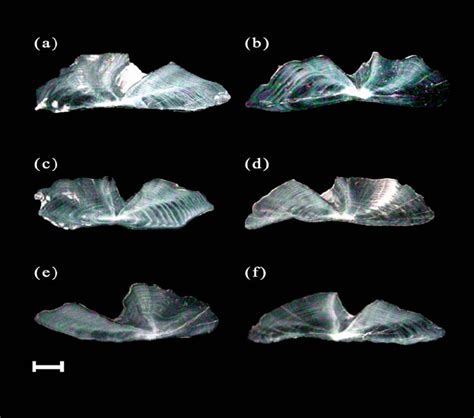 Photomicrographs Of Transverse Sections Through Sagittal Otoliths Of