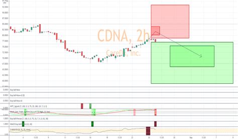 CDNA Stock Price and Chart — NASDAQ:CDNA — TradingView