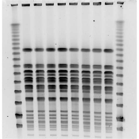 Pulse Field Gel Electrophoresis Profiles From Urine Li Isolated Download Scientific Diagram